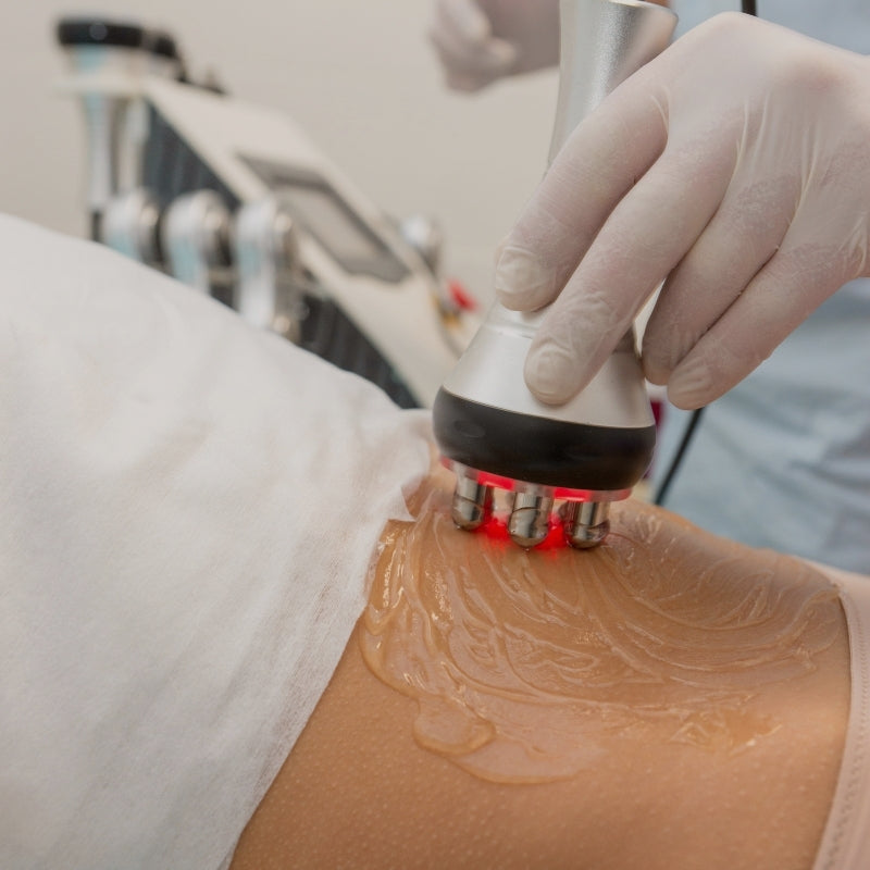 Person receiving a skin tightening treatment with a device