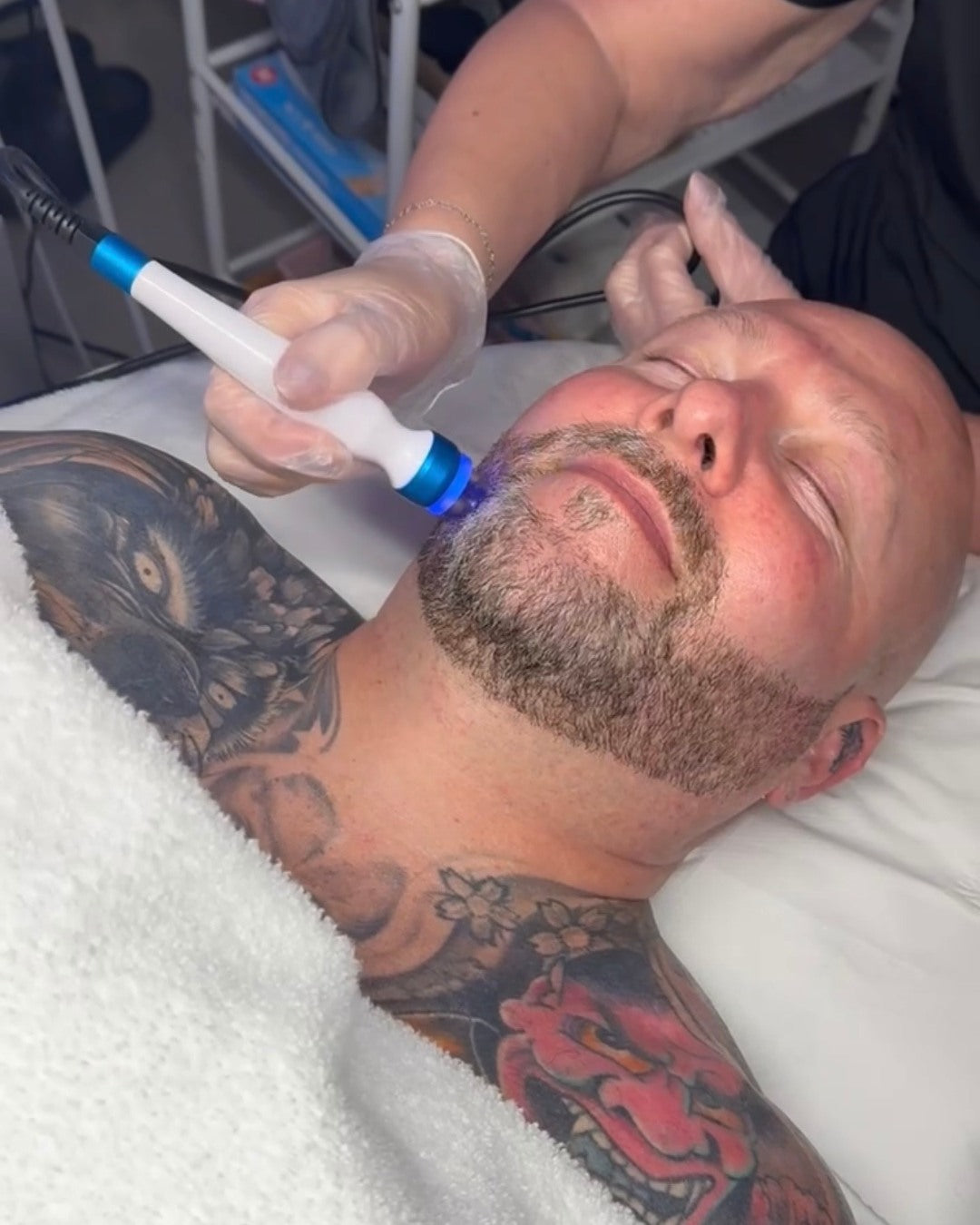 Men's skin treatment at Foxvar Clinic, Newcastle